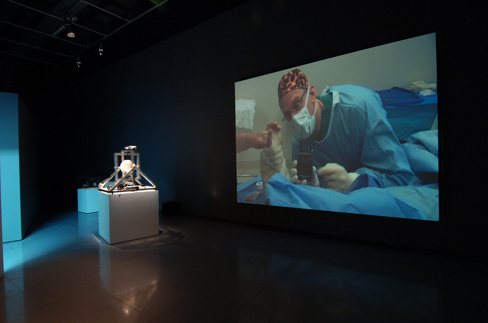 Stelarc, Extra Ear: Ear On Arm. Installation view at FACT.