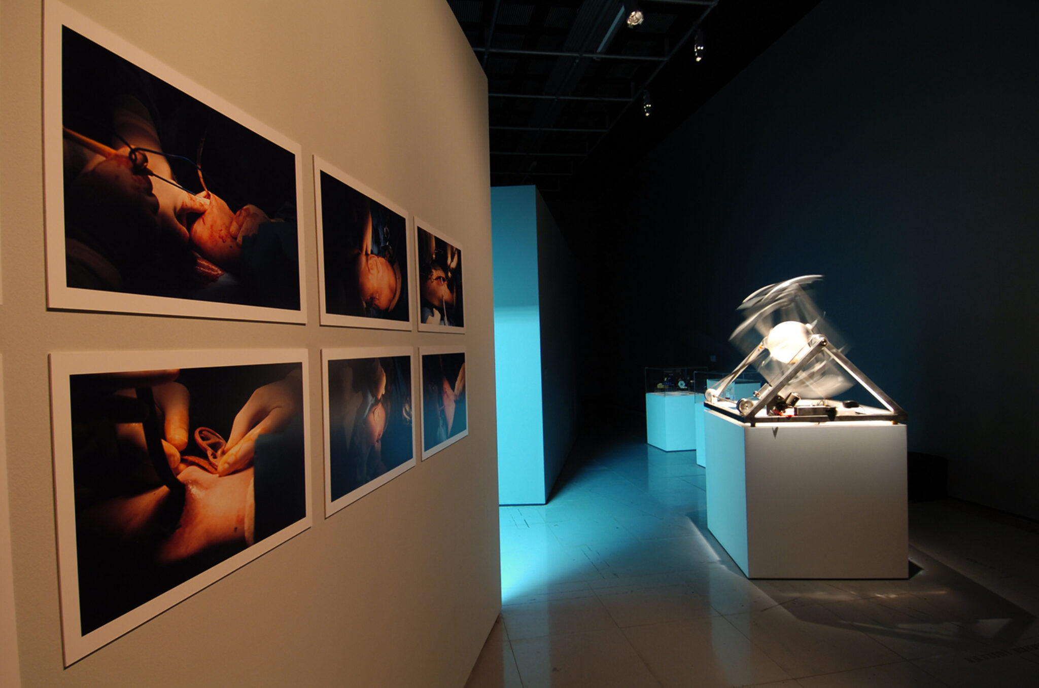 Stelarc, Extra Ear: Ear On Arm. Installation view at FACT.